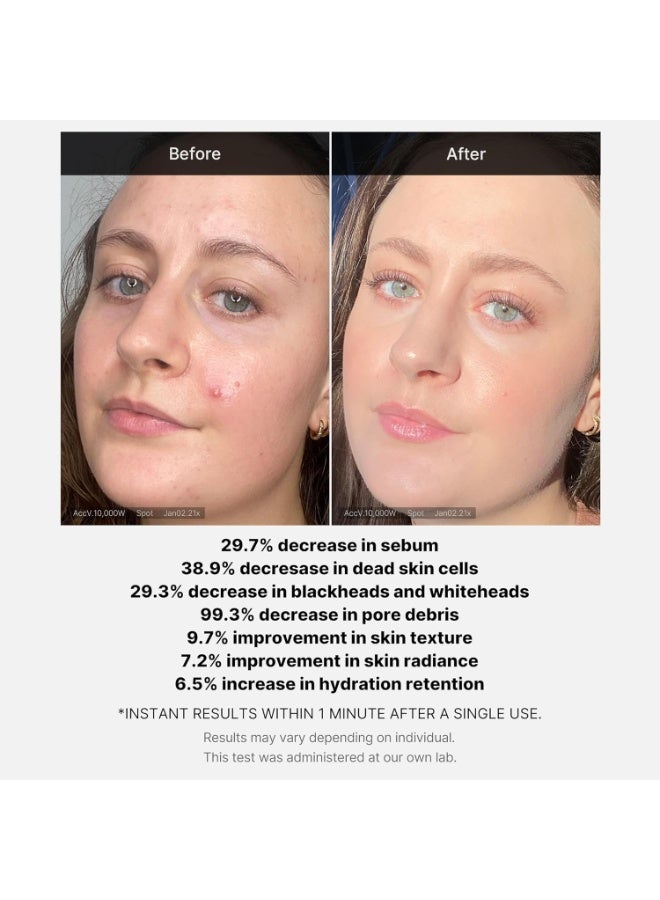 Medicube 21% Acid Wash-off Exfoliant (AHA+BHA+Succinic Acid) || Red Line's 1 minute peeling solution for Acne-prone skin | Non-irritating but effective | Korean Skincare - Image 5